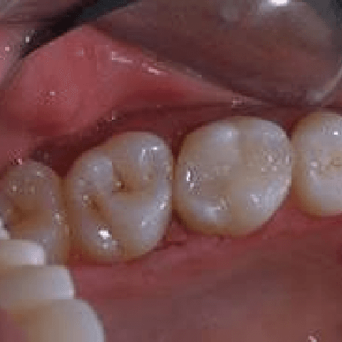 Millersville Family Dentistry — photo 2
