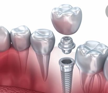 Downers Dental — photo 2