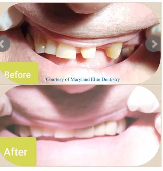 Ava Parakhoodi DMD- Maryland Elite Dentistry — photo 2