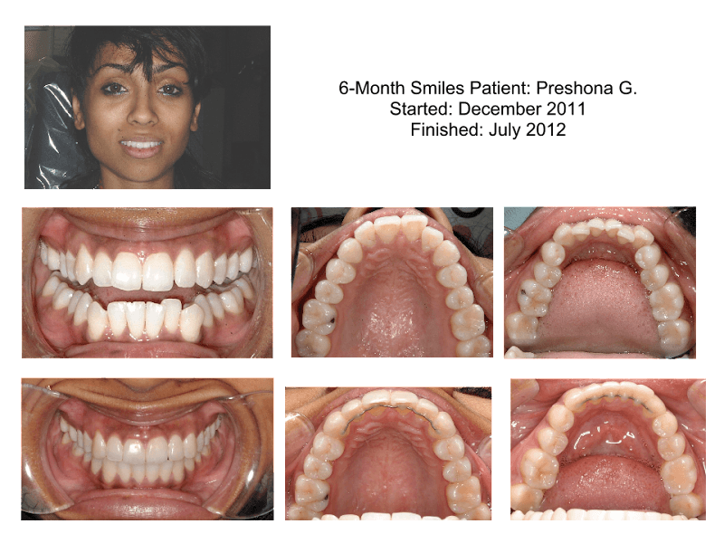 Howard County Family Dentistry — photo 4