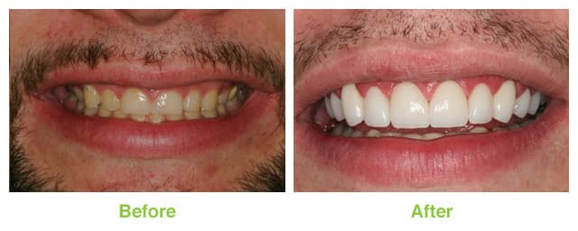 Salt Lake Dental Care - Clint Blackwood DDS — photo 4