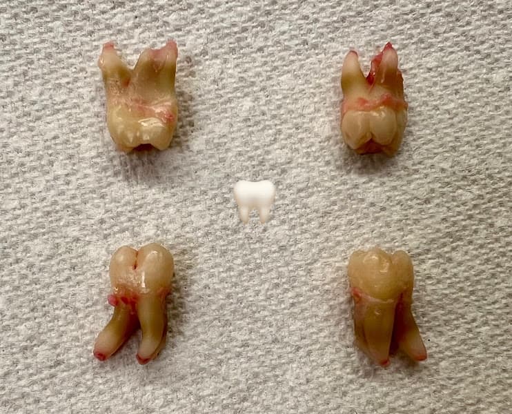 Idaho Falls Smiles Justin G Frandsen DDS and Brandon S. Griffin DMD — photo 3