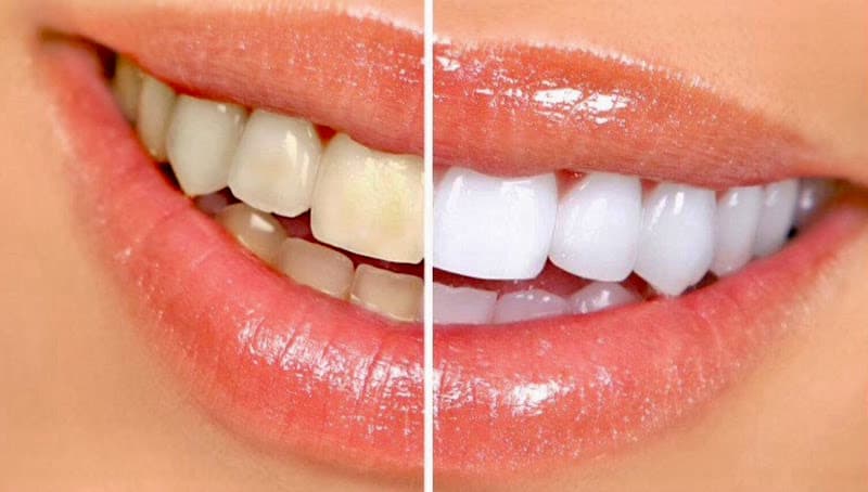 Connecticut Dental Group- M. Azar DDS — photo 2