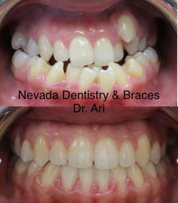Nevada Dentistry & Braces — photo 2