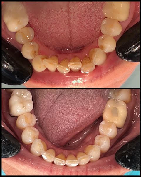 Rapid City Smiles: Implant & Family Dentistry - Dr. Dan Graves DMD — photo 2
