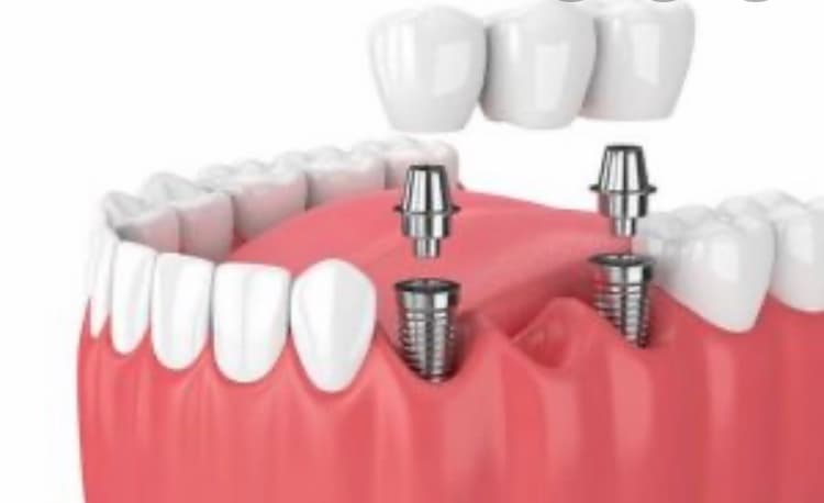 Downers Dental — photo 3