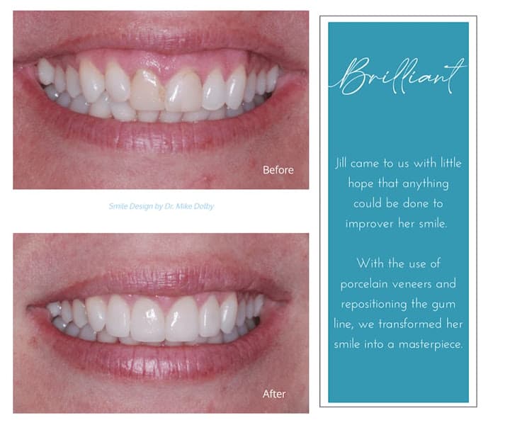 Cottonwood Creek Dental / Dr. Michael Dolby — photo 2