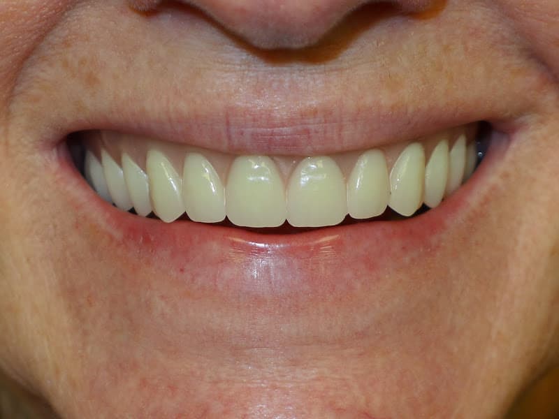 Evergreen Dental Care — photo 4