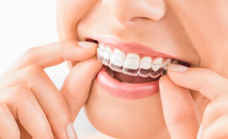 Maiden Lane Dental — photo 2