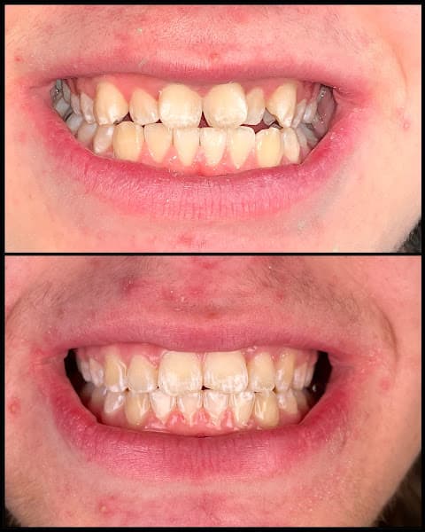 Rapid City Smiles: Implant & Family Dentistry - Dr. Dan Graves DMD — photo 3