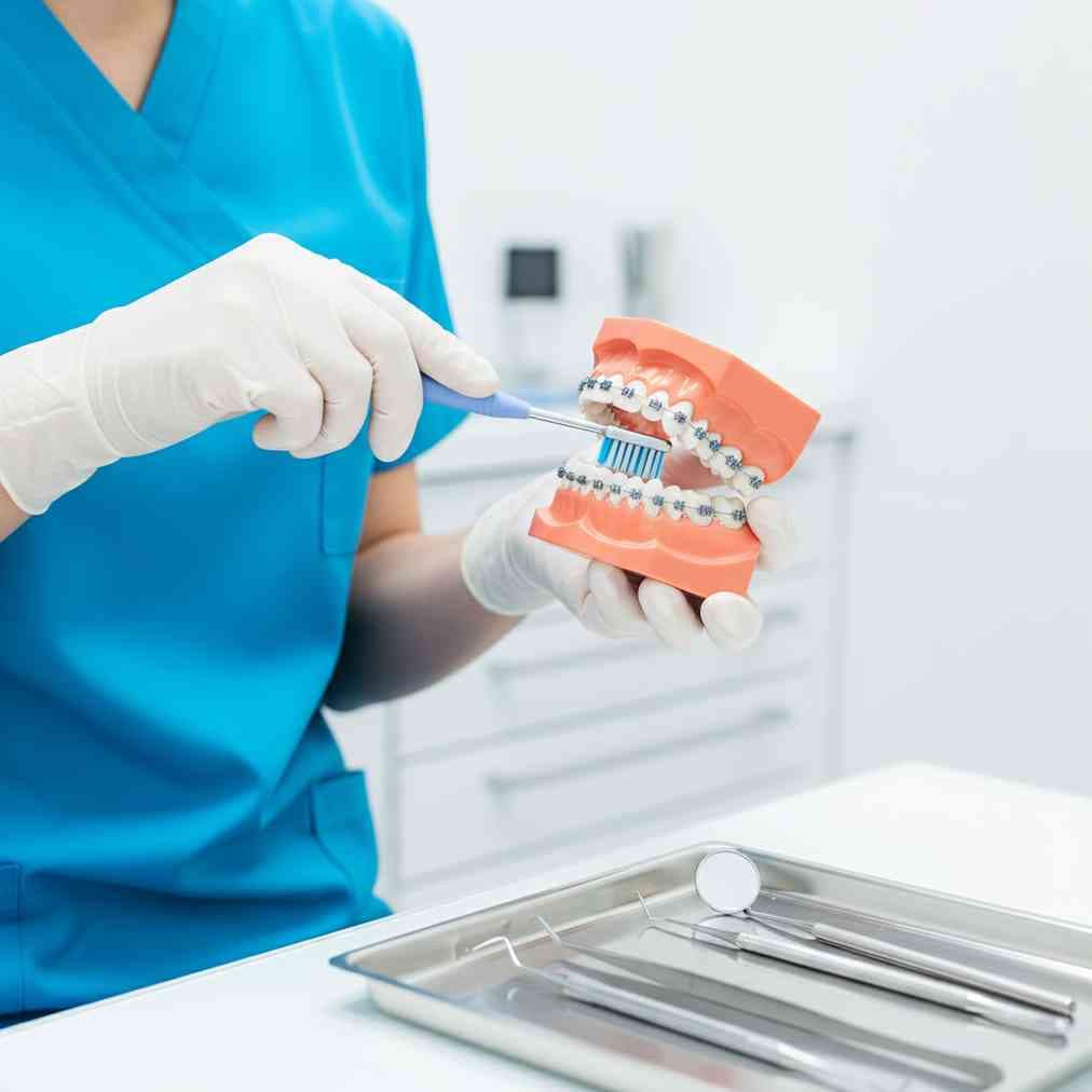 Preventive care and at-home tips recommended by Orthodontists