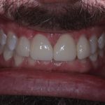 Professional portrait of Dr. Jacob Burch, General Dentist at Ayden Family Dentistry