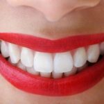Dr. Dickey - Dentist at Big River Dental