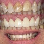 South Lincoln Family Dentistry Professional