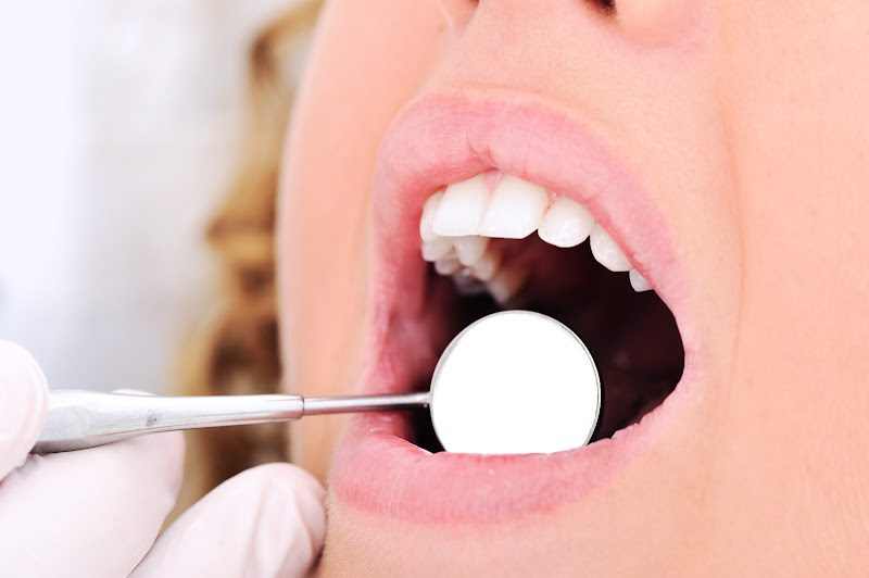 Dental Checkups