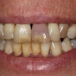 Dr. Mohammad K. Zaman, specializing in dental implants and aesthetic dentistry