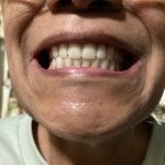 Dr. Harshavardhan Garla, DDS