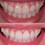 Dr. Sydney Joyce, Cosmetic Dentist