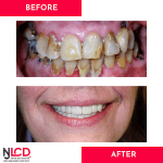Dr. Joseph M. DalBon, DMD
