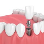 Nevada Dentistry & Braces Team