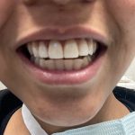 Absolute Dental Aliante Clinic Photo