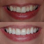 Dr. Michael Firouzian, DDS