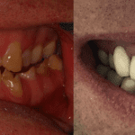 Dr. Reza Radmand, DMD, FAAOM
