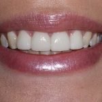 Healthy Smiles of Birmingham Team