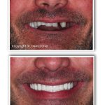 North Texas Dental Surgery Team