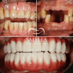 Professional portrait of Dr. Everett Heringer, a friendly male dentist smiling.