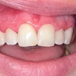 Dr. Ayaz P. Jafri - Dentist at Mid Michigan Dental Center