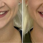 California Dental Design Lab Technicians