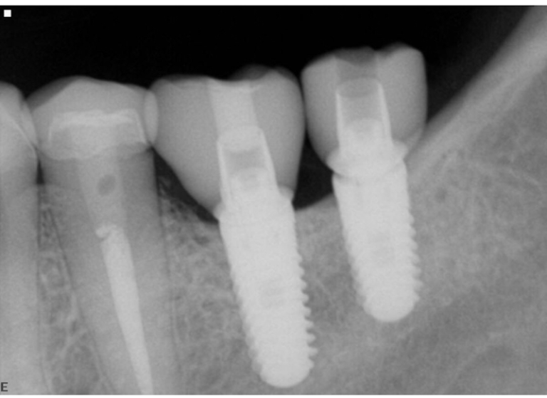 Bell Road Dental Care