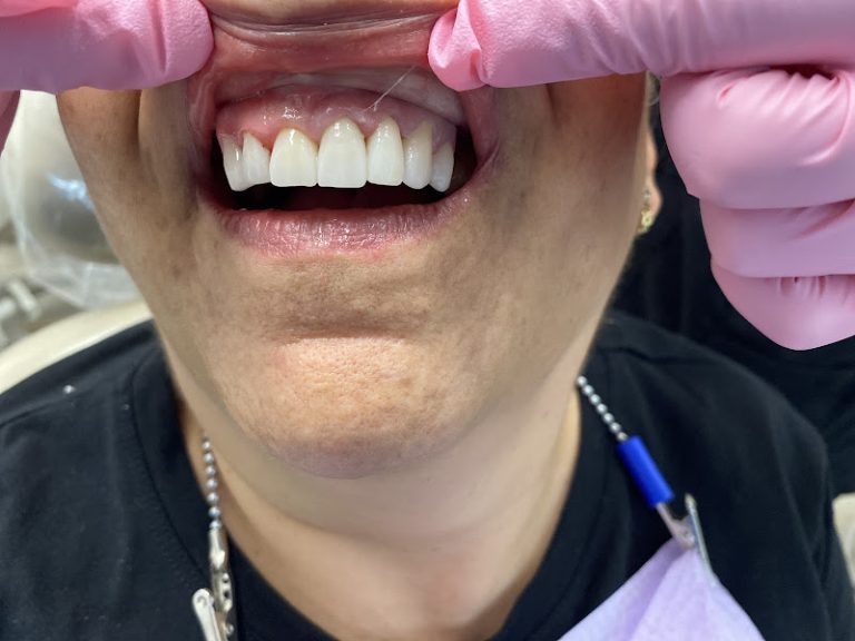 H&M Cosmetic Family Dentistry / Clinica Dental Hispana & Dental Laboratories - Gaithersburg