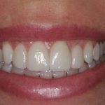 Dr. Nathan Deeter, DDS