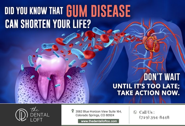 photo c1c427a4 2376 4fbe 9ebb dbd2f352d9a9 768x522